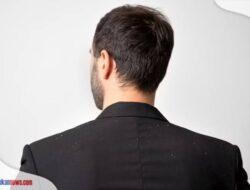 11 Cara Menghilangkan Ketombe dan Rambut Rotok, Buat Rambut Jadi Lebih Sehat!